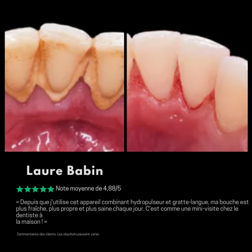 Toothly hydropulseur™