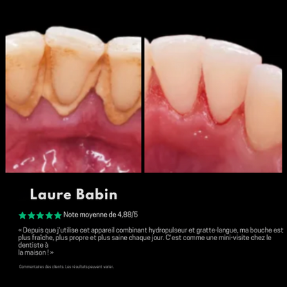 Toothly hydropulseur™